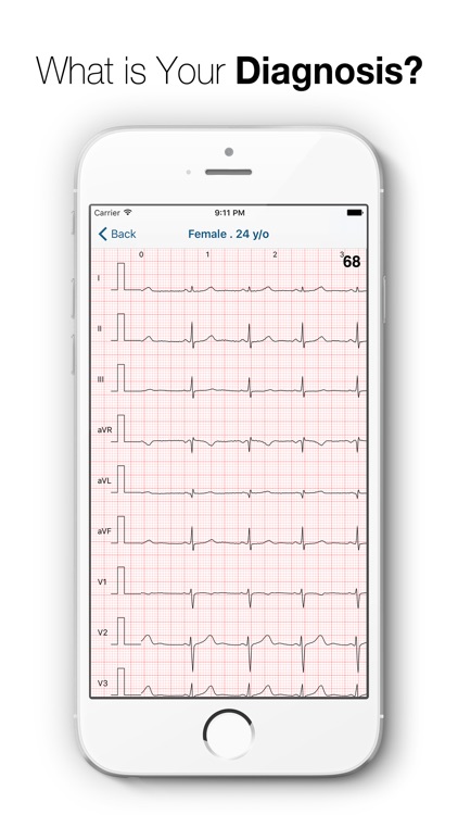 ECG Test - Challenge Your Interpreting Skills