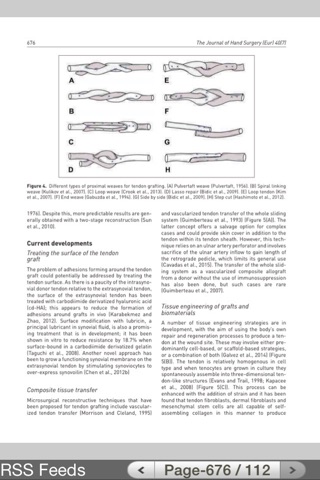 Journal of Hand Surgery (E) screenshot 4