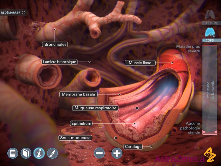 Living Lung