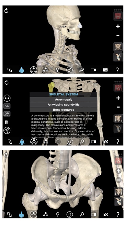 3D Organon Anatomy - Skeleton, Bones, and Ligaments