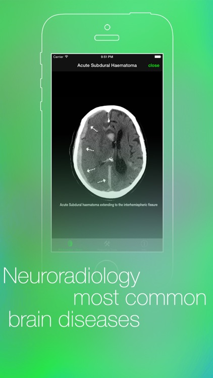 iRadiologist - Brain