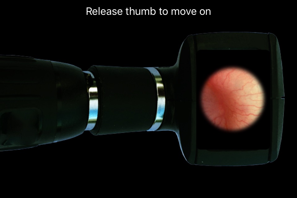 Otoscope Simulator screenshot 2