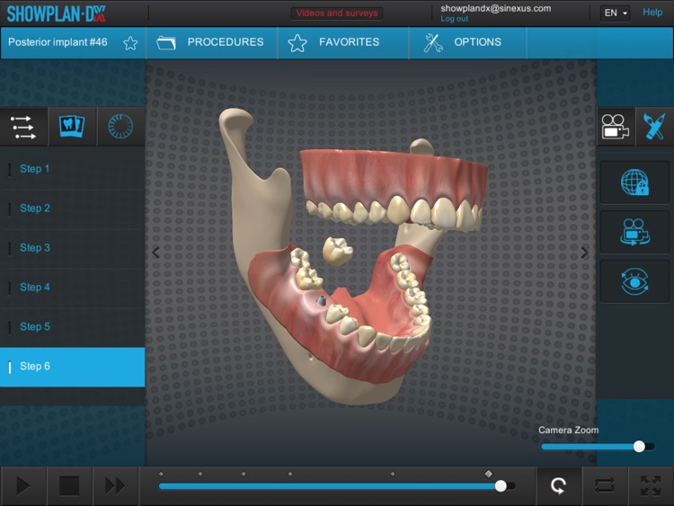 Showplan-DX - Dental