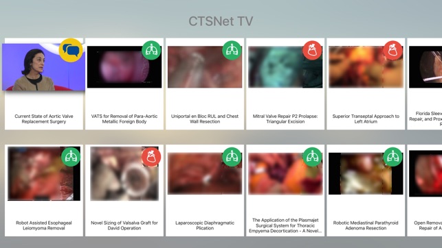 CTSNet TV