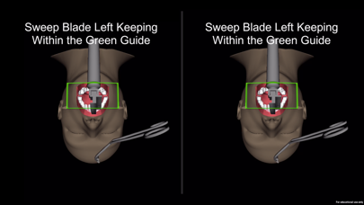 How to cancel & delete Laryngoscopy AR from iphone & ipad 4