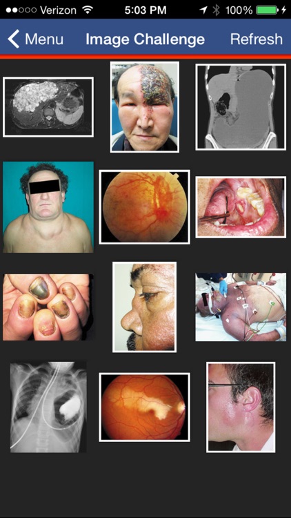 NEJM Image Challenge