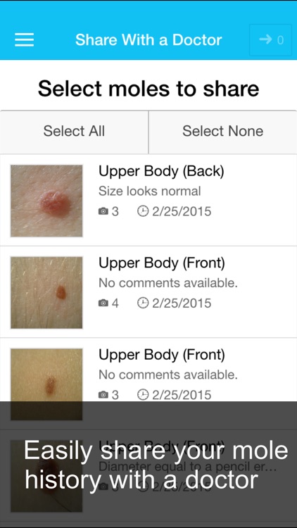Skin Cancer App - MySkinPal - Map your skin moles screenshot-4