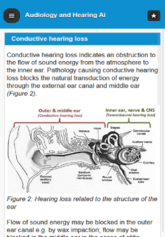 Audiology and Hearing Aids for Otolaryngologist screenshot 2