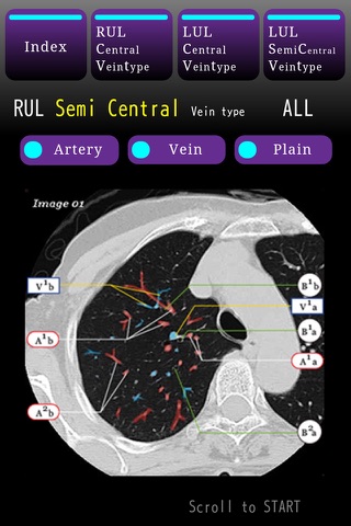 LungCT Anatomy STUDY iP screenshot 2