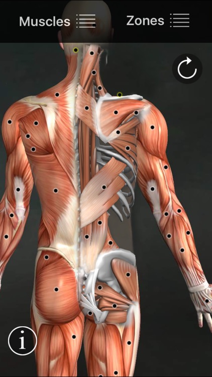 Muscle Trigger Points screenshot-0