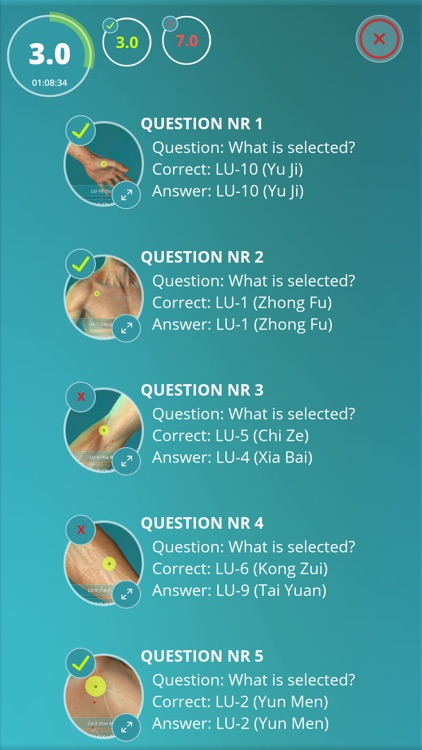 Acupuncture Quiz - Point Locations screenshot-3