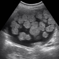ARRT Sonography (Ultrasound) Flashcards Lite PC 용