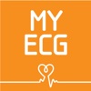 My ECG