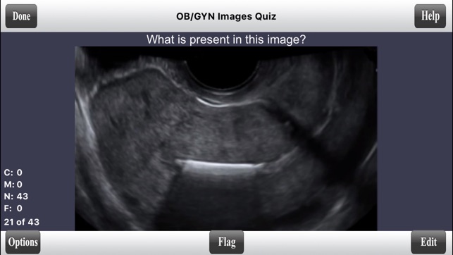 ARDMS OBGYN + Abdomen Boards Ultrasound Flashcards(圖4)-速報App