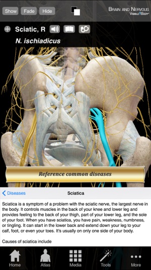 Brain and Nervous Anatomy Atlas: Essential Reference for Stu(圖5)-速報App