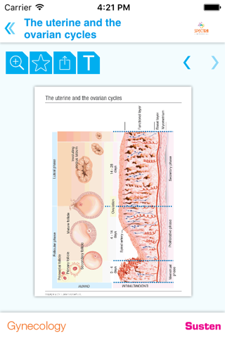 Mini Atlas Gynaecology screenshot 3