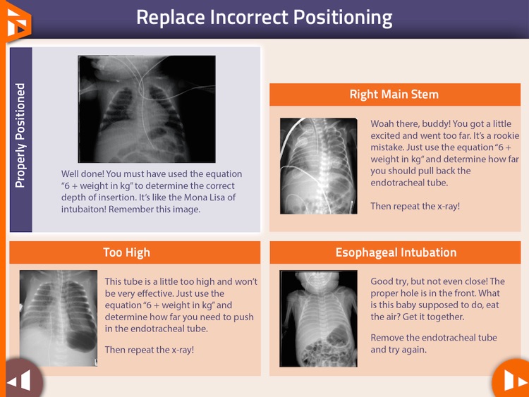 Neonatal Airway