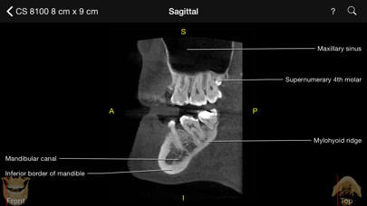 How to cancel & delete CBCT from iphone & ipad 1