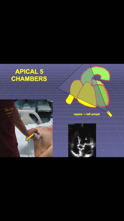 Ultrasound ABC...