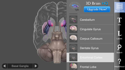 How to cancel & delete 3D Brain from iphone & ipad 4