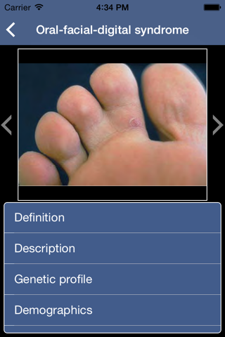 Genetic Disorders and Syndromes Pocket screenshot 2