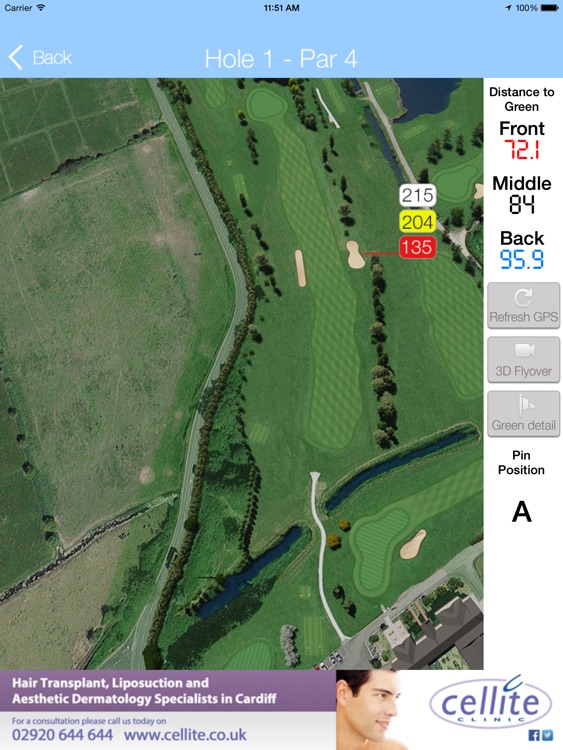 Peterstone Lakes Golf Club - Buggy