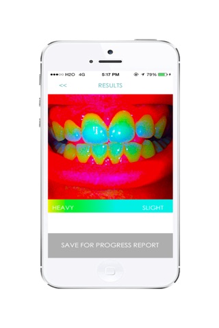 Smile - Dental Hygiene Analysis screenshot 2