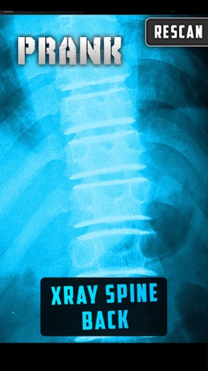 Simulator X-Ray Spine Back(圖1)-速報App