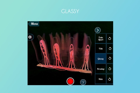 Intestinal Villi 3D screenshot 2