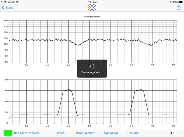 Simulated Electronic Fetal Monitor(圖4)-速報App