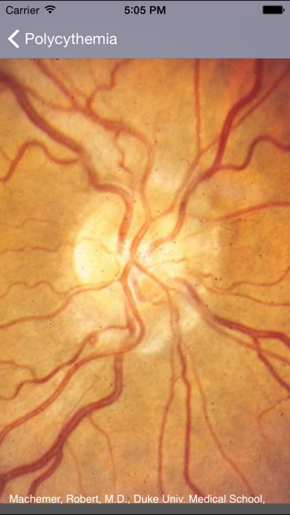 Atlas of Ophthalmology screenshot-3