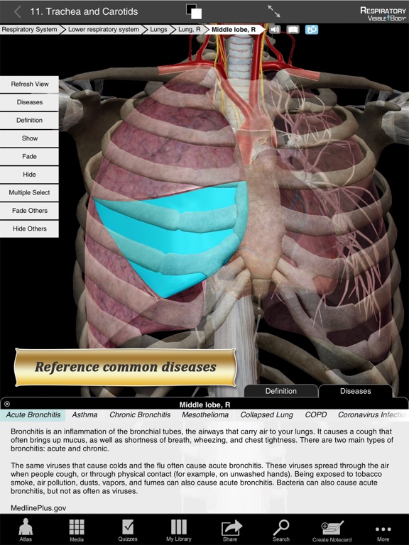 Respiratory Anatomy Atlas: Essential Reference for Students and Healthcare Professionalsのおすすめ画像5