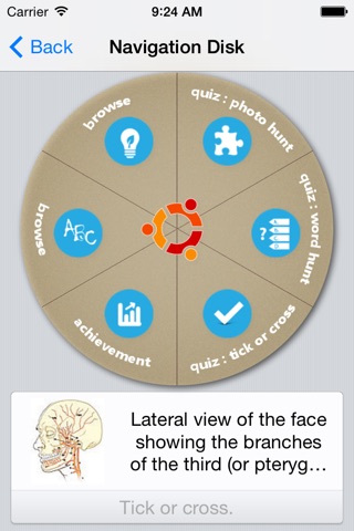 Isaiah cerebral vascular Atlas screenshot 2