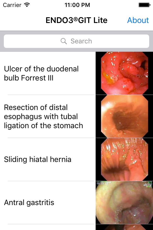 ENDO3® Atlas of Gastrointestinal Endoscopy - Lite screenshot 2