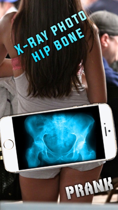 How to cancel & delete Simulator X-Ray Photo Hip Bone from iphone & ipad 1