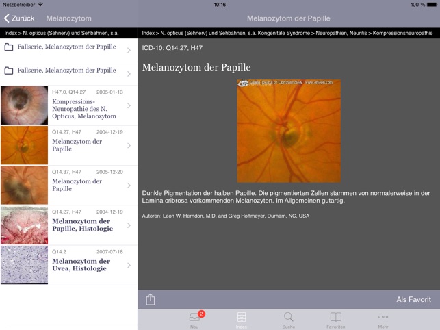 Atlas of Ophthalmology HD by Onjoph(圖2)-速報App