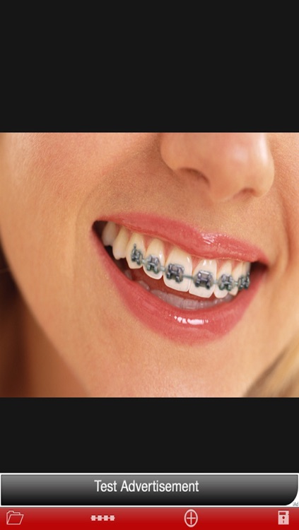 Orthodontic تقويم الاسنان screenshot-3