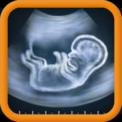 Ultrasound Spoof 2016: Pregnancy Test iOS App