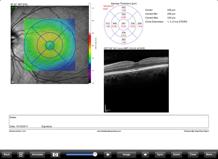 SMIPS Visualizer screenshot-3