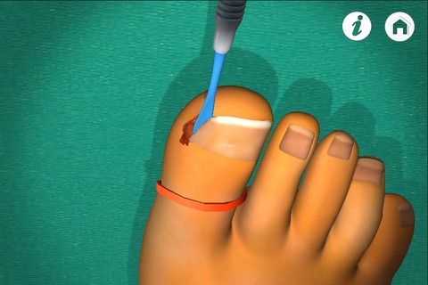 Podiatry 3D (Free Version) screenshot 4