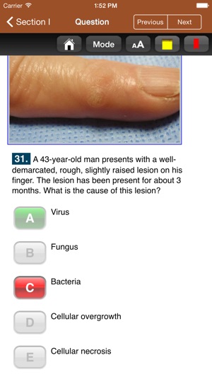 USMLE Images for the Boards(圖2)-速報App