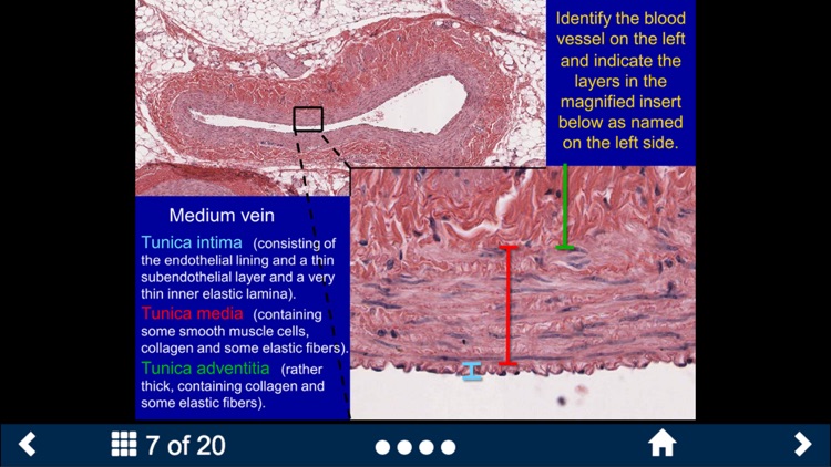 Histology Lite - SecondLook