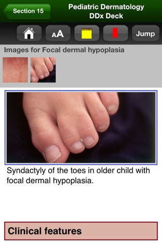 Pediatric Dermatology DDx Deck screenshot 3