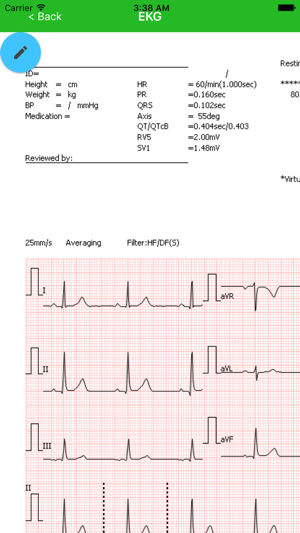 EKG(圖2)-速報App