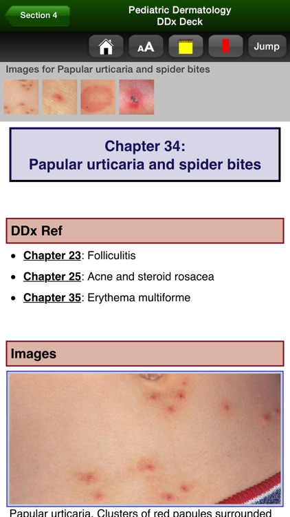 Pediatric Dermatology DDx Deck