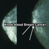 Know About Breast Cancer Free