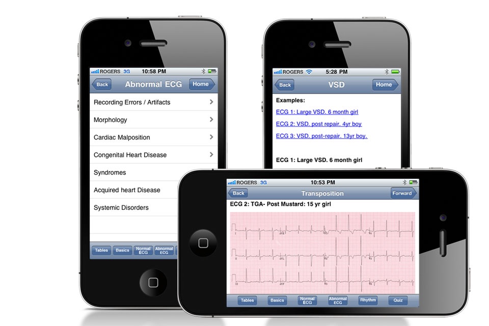 Paed ECG screenshot 4