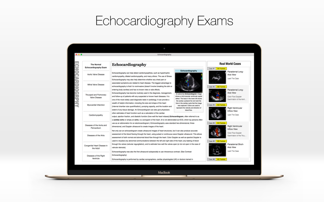 Echocardiography - Case Study and Review