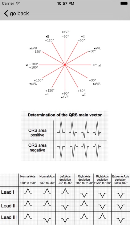 Learn ECG screenshot-4