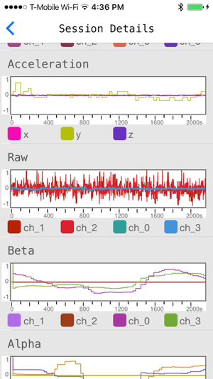 BrainLog: An EEG recorder(圖1)-速報App